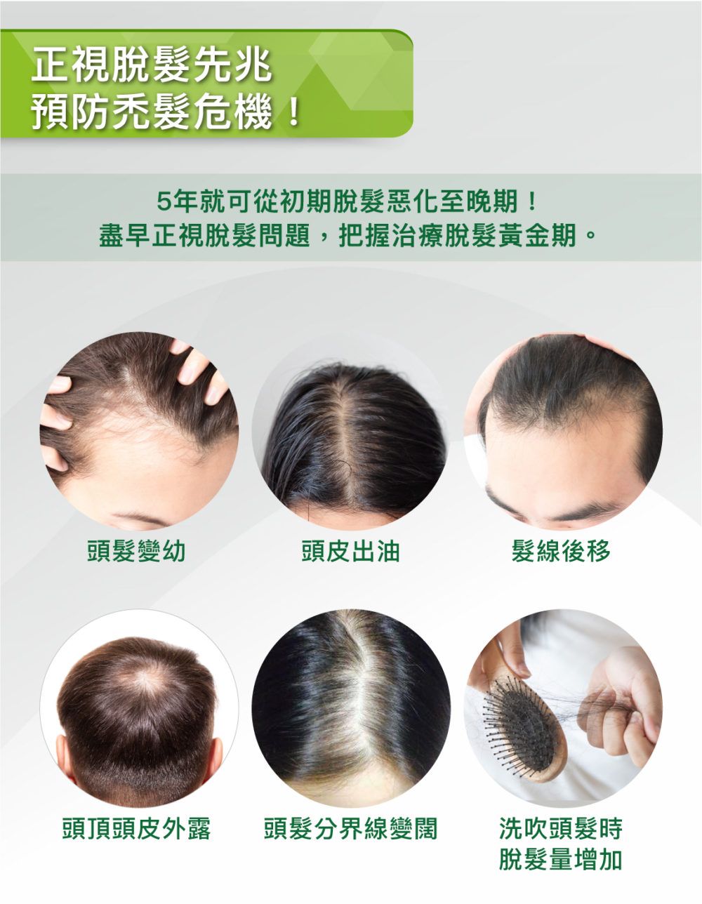 20211011_HAIR-FOREST_Eshop_BF人工植發-KL-content05-1000x1288.jpg