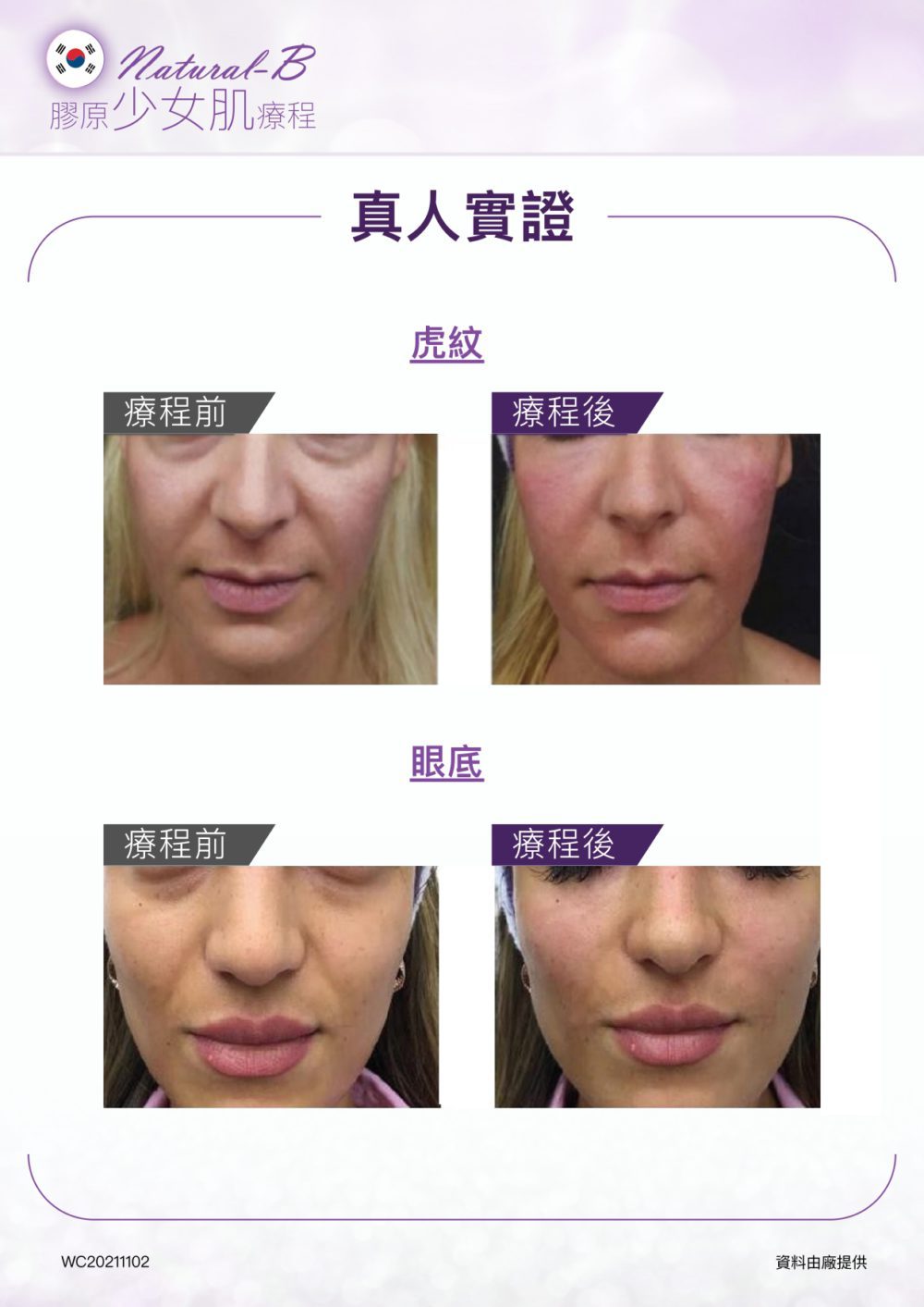 Natural-B-P2P_outline_V3_page-0008-1000x1413.jpg