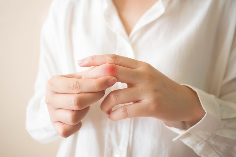 手指關節痛怎麼辦？是關節炎嗎？學會4招手指關節保養方法Lyprinol立適得||專利綠唇貝萃取物呵護行動力