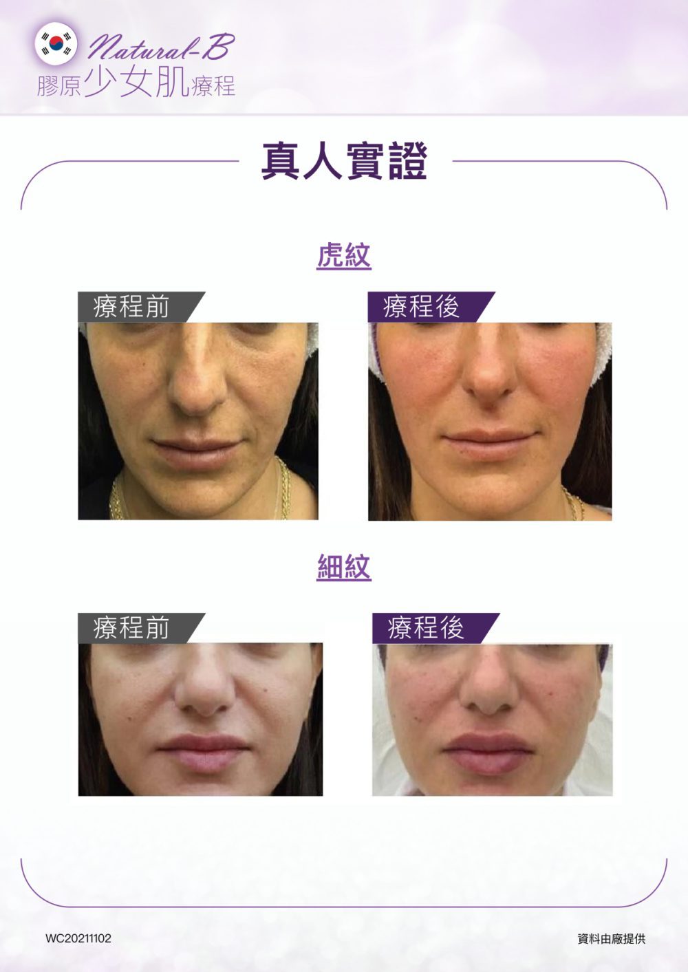 Natural-B-P2P_outline_V3_page-0009-1000x1413.jpg