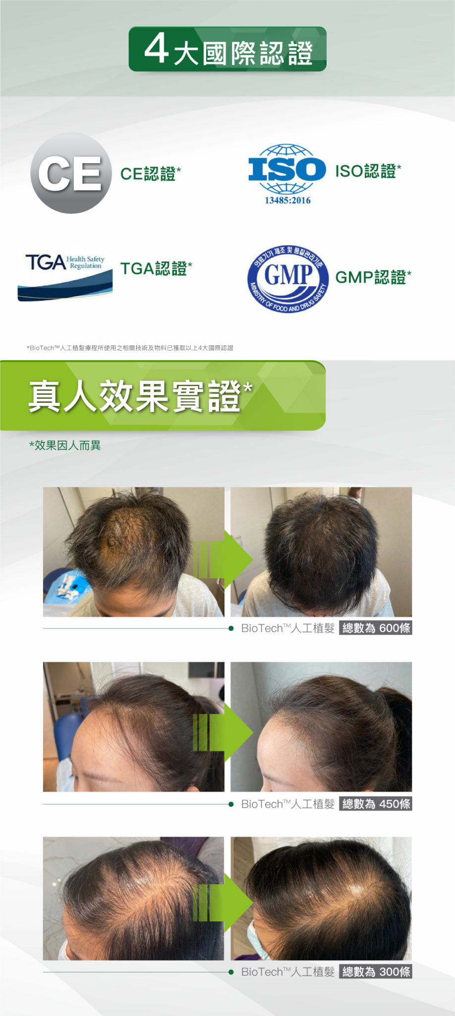 20211011_HAIR-FOREST_Eshop_BF人工植發-KL-content02-918x2048.jpg