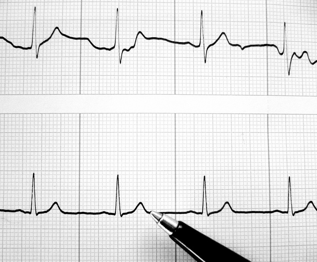 AI 诊断心电图，揪出需治疗的心律不整病患| TechNews 科技新报