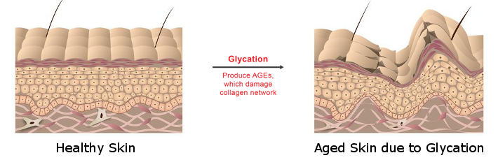 glycation1.png